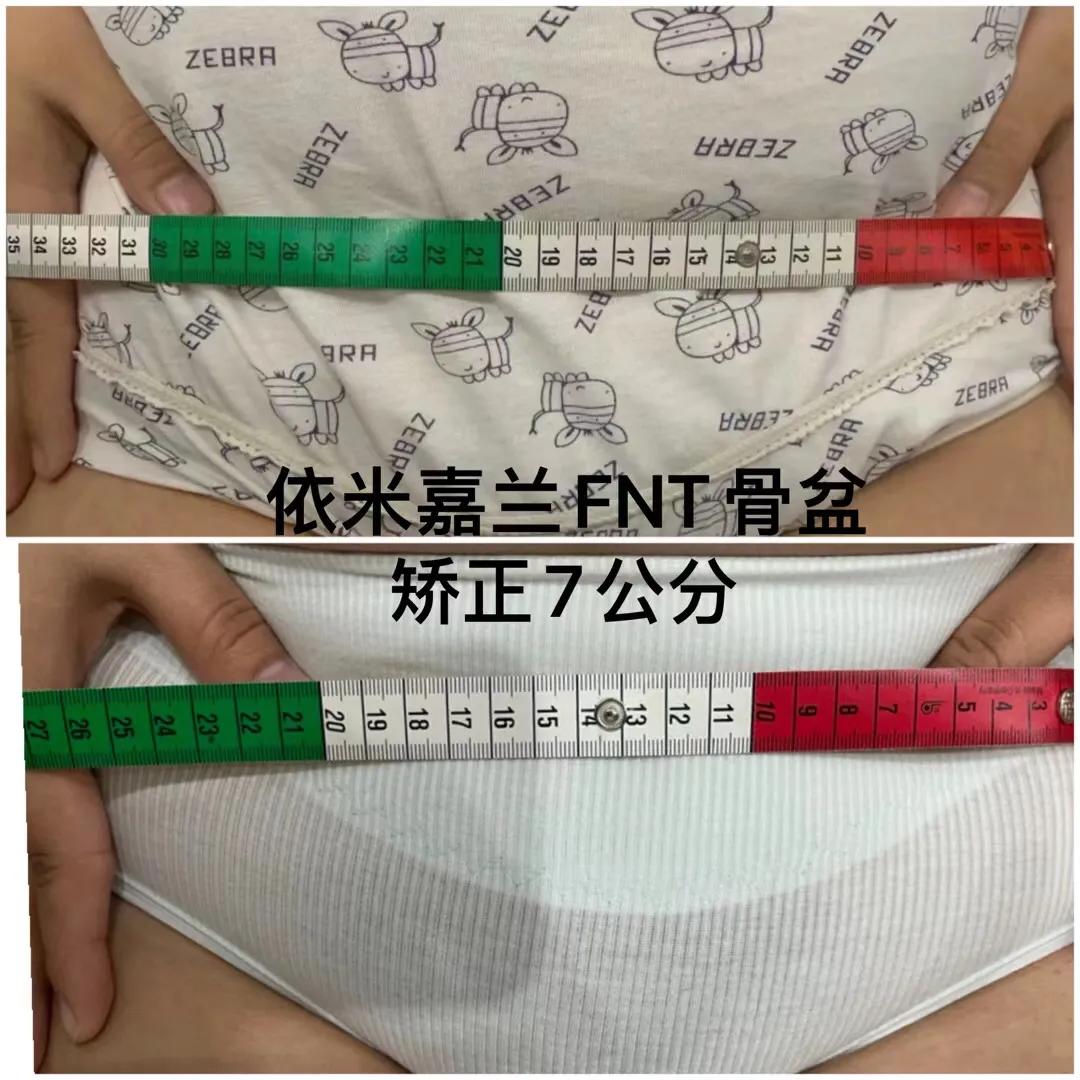 依米嘉兰产后恢复加盟费多少钱,依米嘉兰护理中心