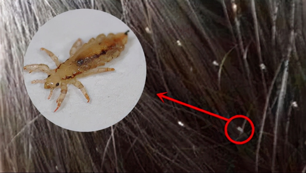 人类褪去体毛之后，裸体生活了100万年，为何后来又穿上了衣服？