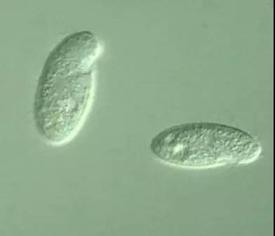 污泥镜检操作方法,污泥检测项目及标准有哪些呢