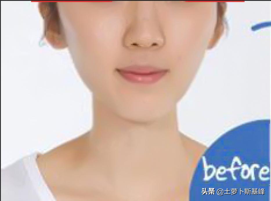 ps处理双下巴几种方式,胖子的双下巴怎么ps