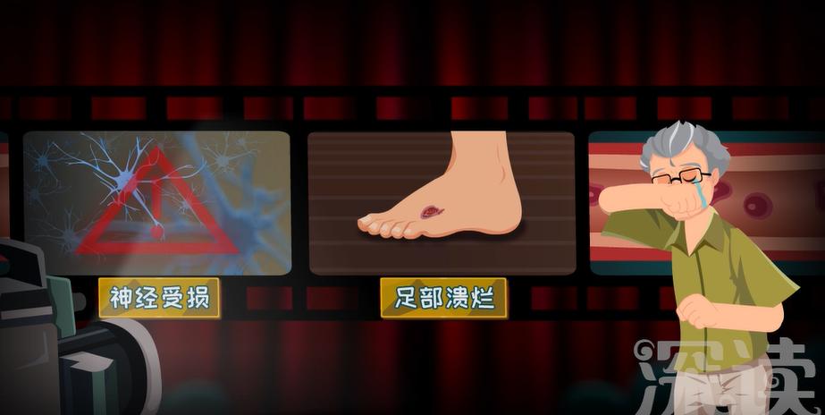 糖尿病足截肢步骤,干性糖足坏疽必须截肢吗