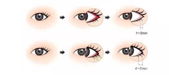 名门泽佳的正确涂法,名门泽佳祛皱小细节