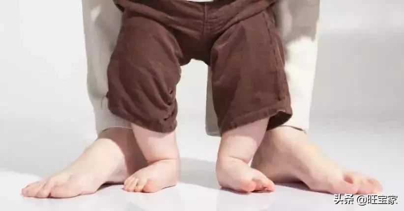 林允儿天使照,林允儿o型腿怎么变直的