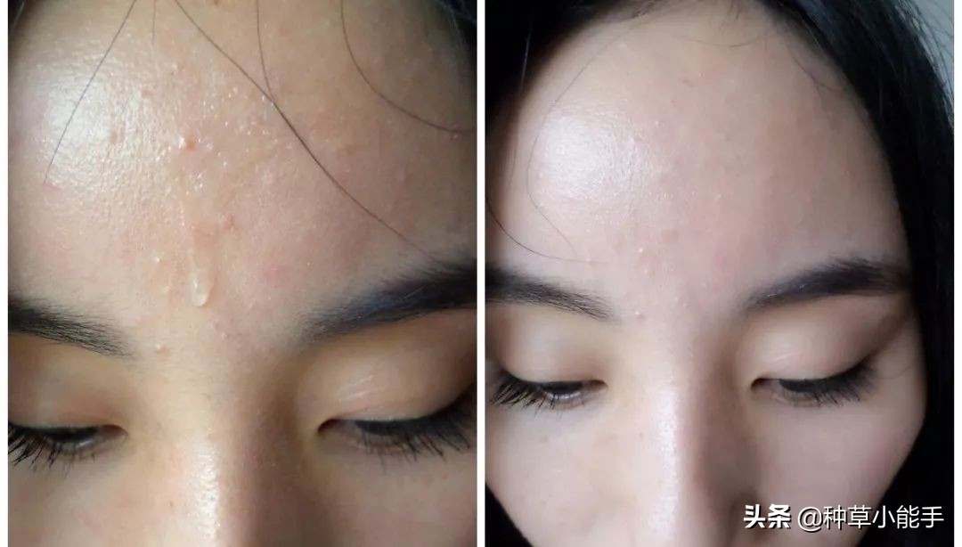 一抹磨皮棒,一抹磨皮