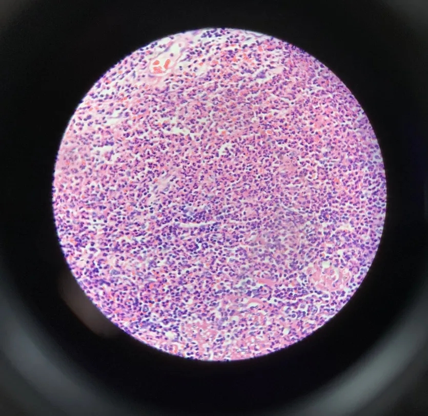 医学生学习打卡做题,医学生学习成果检验视频