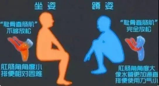蹲坑总是左腿麻是怎么回事,蹲坑蹲到腿麻了用什么姿势