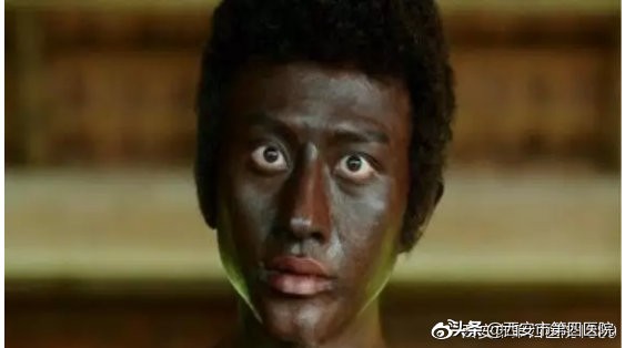 明明涂了那么多的防晒霜额，怎么还是变黑了？