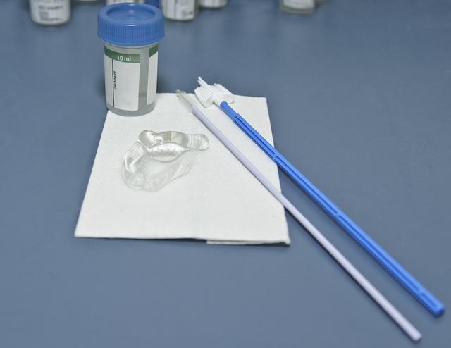 cin1级是宫颈癌吗,宫颈癌cin1级是什么意思