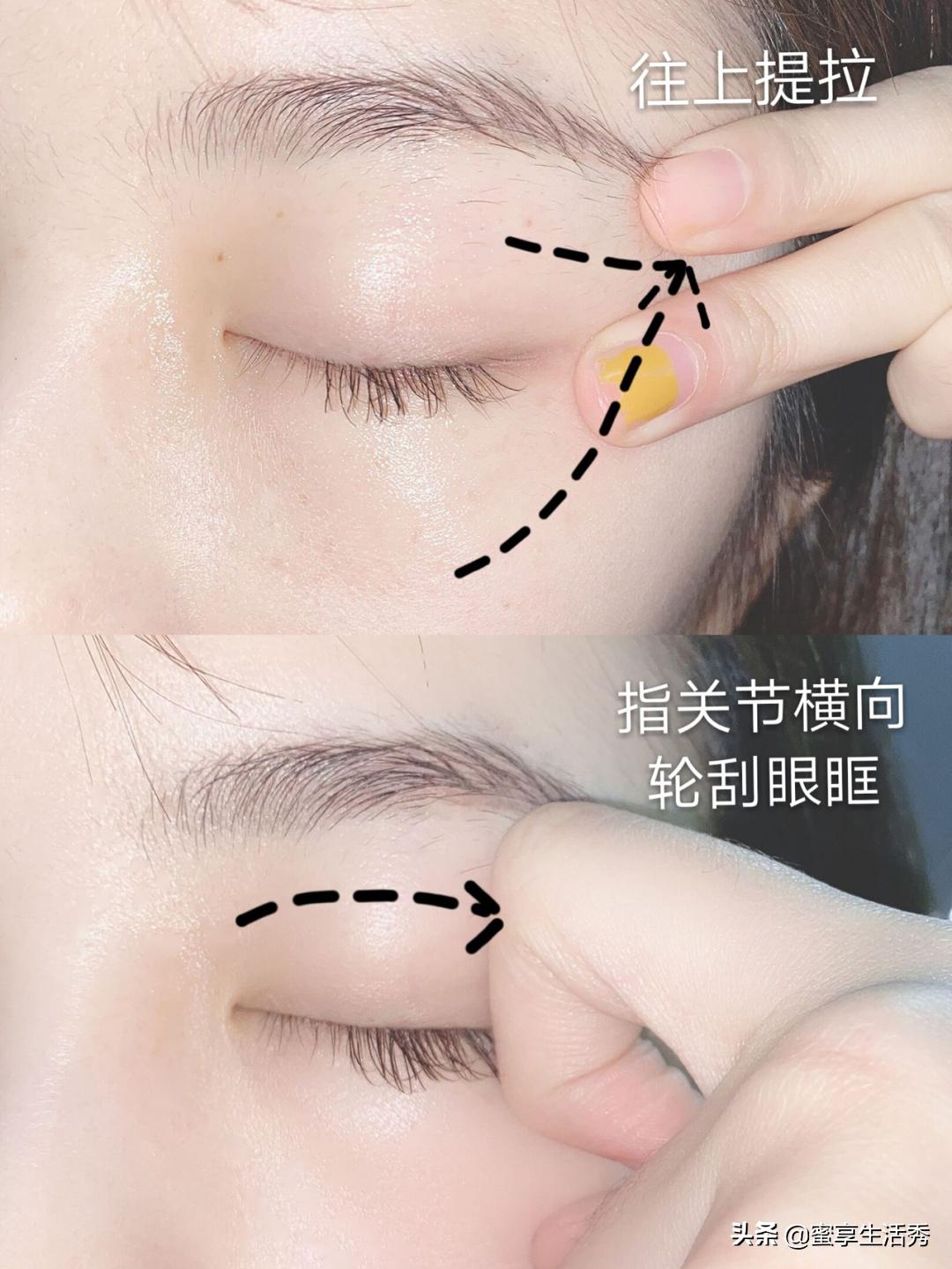 内双眼皮手术变外双效果,内双眼皮怎么变外双按摩最有效