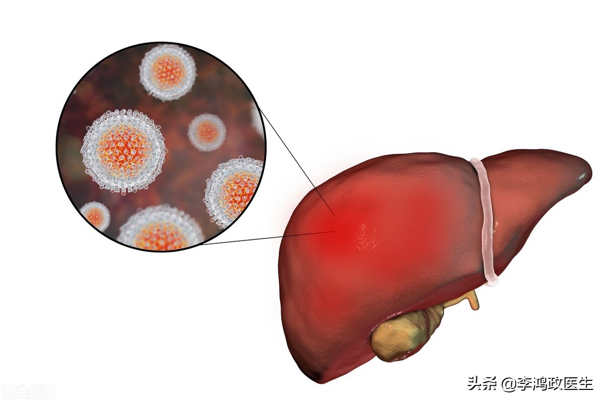 父母病重住进icu是救还是放弃,亲人进icu很难受怎么办