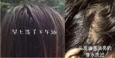 澳洲茶树精油洗发水去头屑,头发一摸全是油