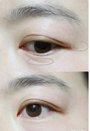 戚薇涂眼霜真的有效果吗,戚薇分享眼霜涂抹方法