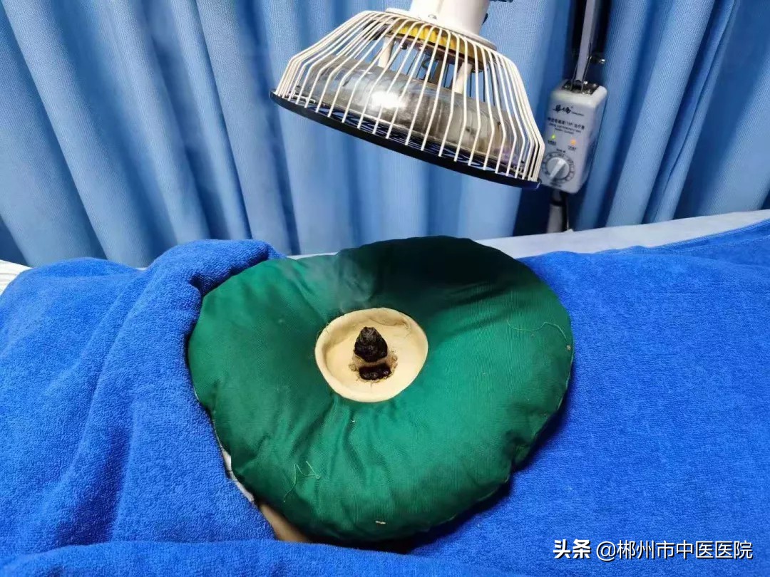 中医月经不调学习把脉方法,昆明看月经不调最好的中医