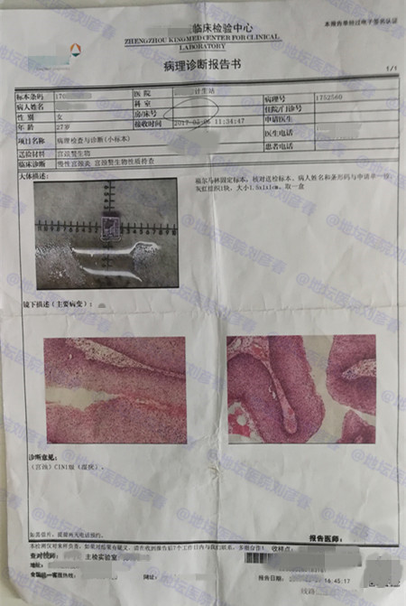 男性有了尖锐性湿疣女性怎么办,男性出现尖锐性湿疣有症状吗