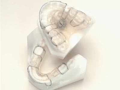 戴保持器期间要注意什么,戴了保持器要注意点什么