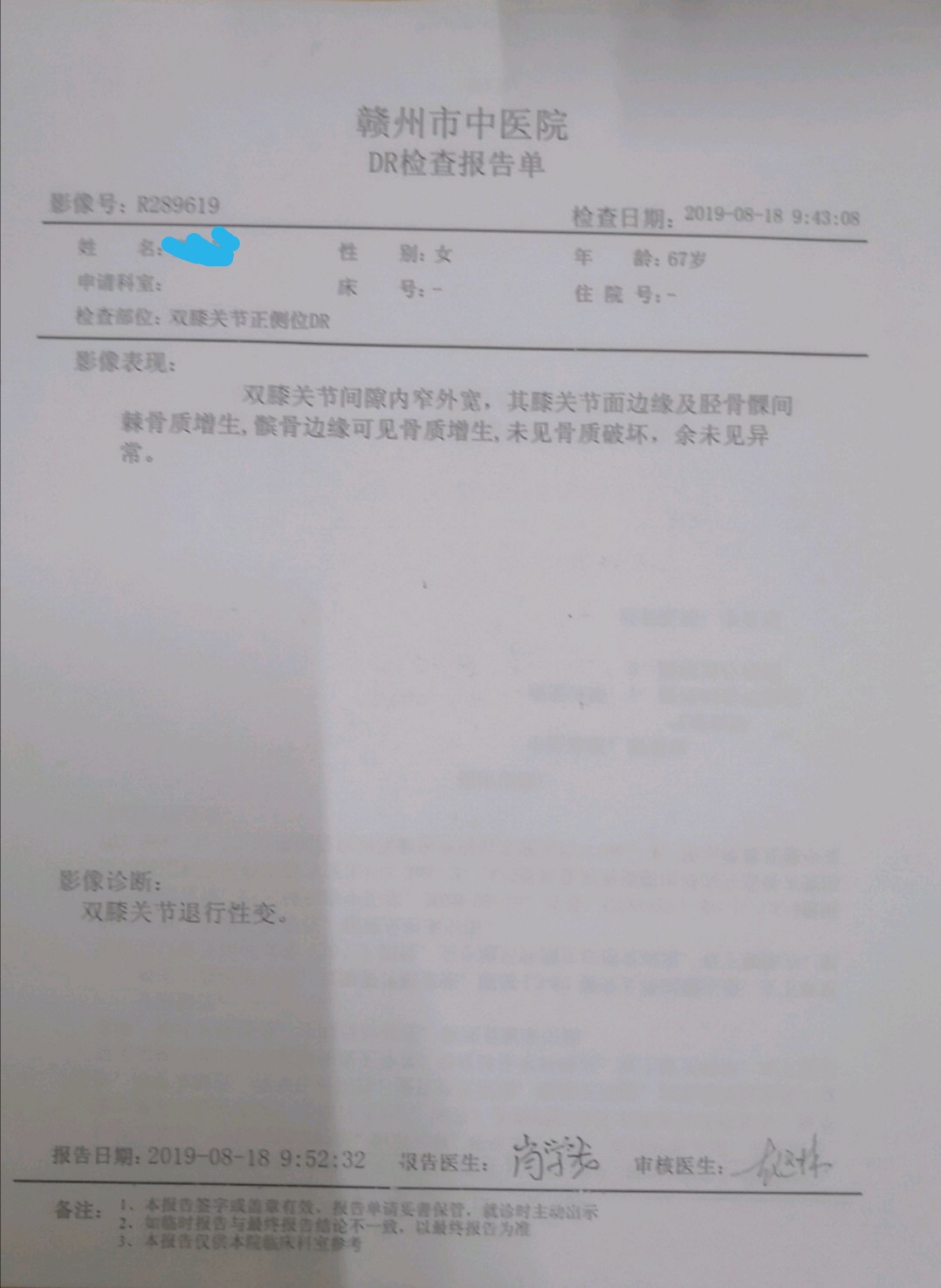 腰椎退行性变是正常的吗,腰椎骨质退行性变