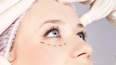 为什么不建议女人割“双眼皮”？主要有这4方面原因，庆幸没跟风