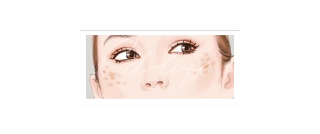 色斑皮肤问题及护肤解决方法,色斑护肤知识