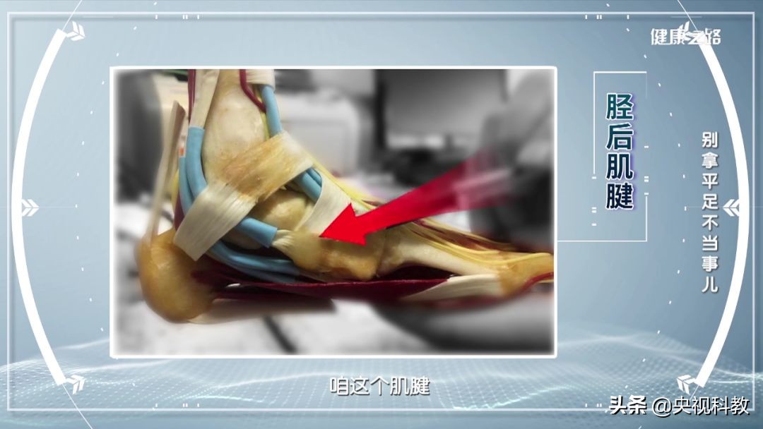 腰疼引起腿和脚麻是怎么回事,经常腰痛原来是脚的问题