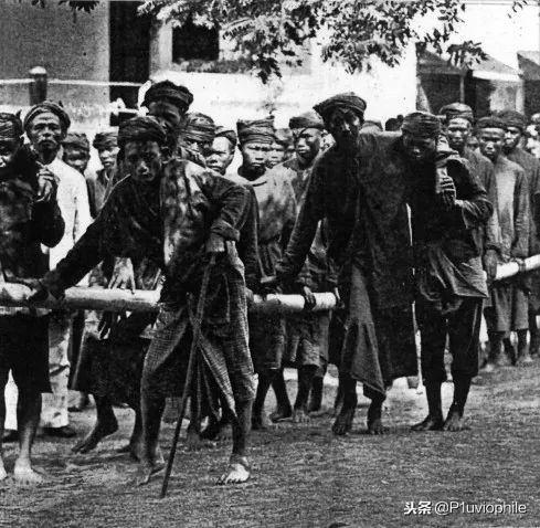 日本人以前得脚气病是什么原因,日本人为什么有脚气