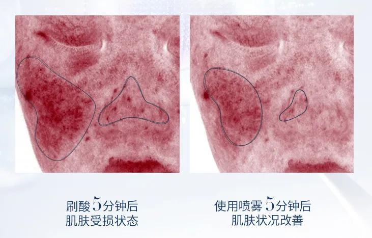 紧绷保湿的水润面部喷雾,改善干燥保湿喷雾