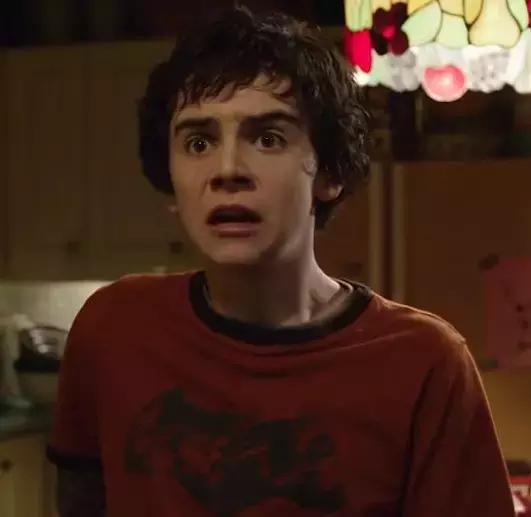 电击脱发,电击治疗斑秃