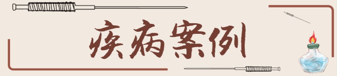 中医火针疗法教学视频,火针操作手法