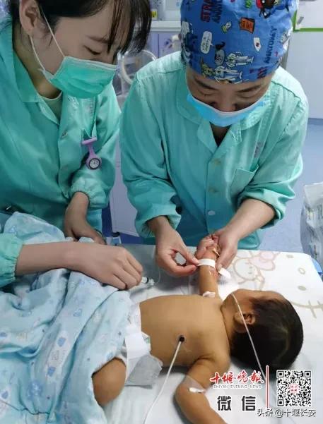 刚出生就换血怎么回事,出生10天全身换血严重吗