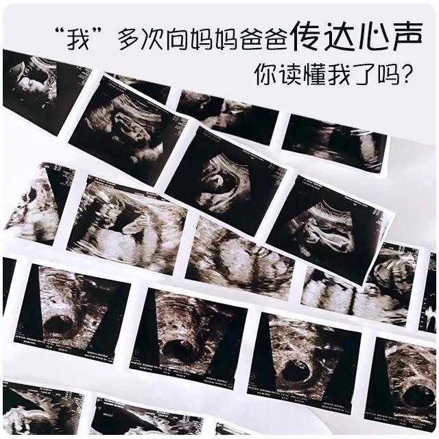 孕期到底需要做几次B超？B超/彩超/三维/四维的区别及选择