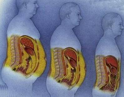 内脏脂肪为什么那么难减,内脏脂肪高吃什么减脂快