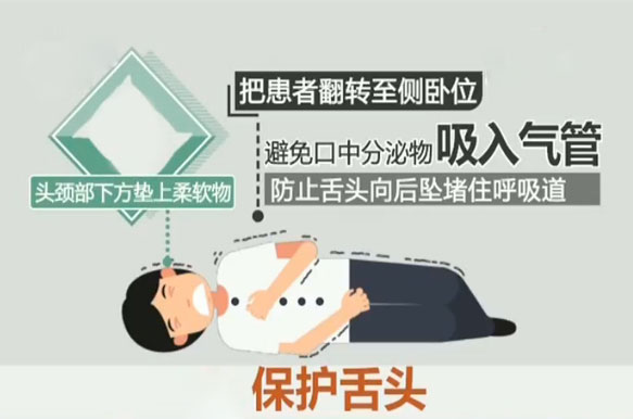 癫痫怎么防护的呢,癫痫患者怎样预防发作