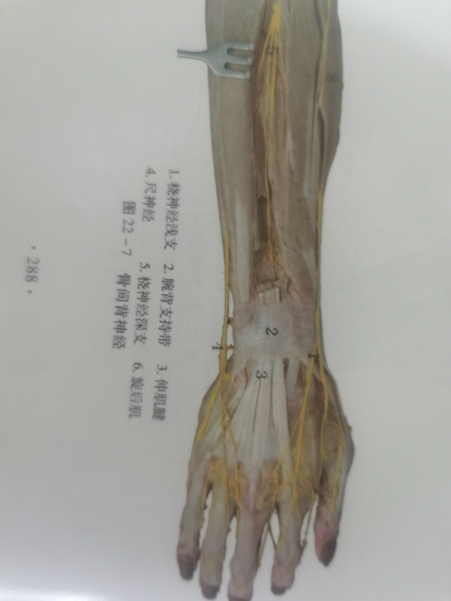 手肘忽然酸痛怎么缓解,手肘酸痛怎么办最快解决方法