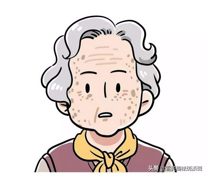 去斑点的最好方法淡斑精华,去斑点的最好方法淡斑