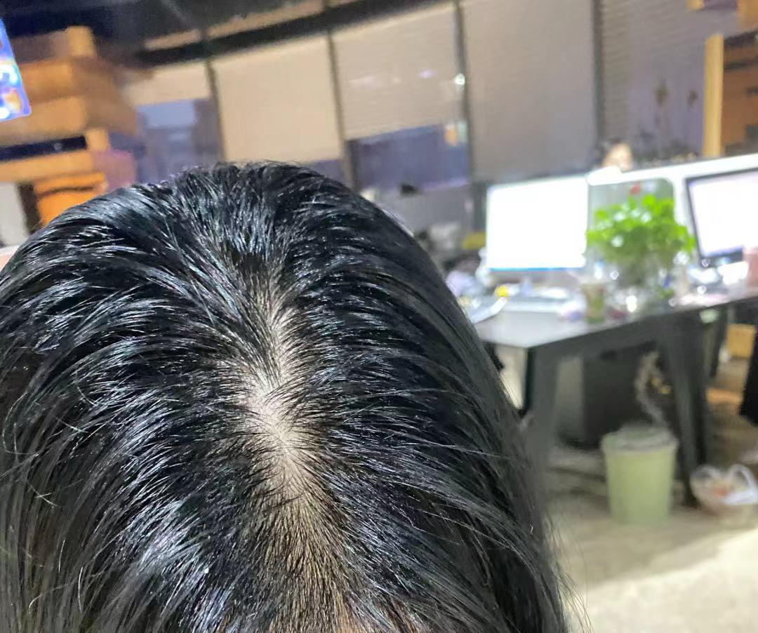 真正能持久控油去屑的洗发水,什么牌子的洗发水好用又香持久