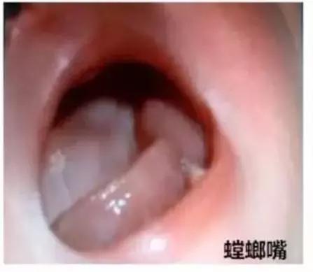 刚出生的宝宝特殊现象,刚出生宝宝吓住了怎么办