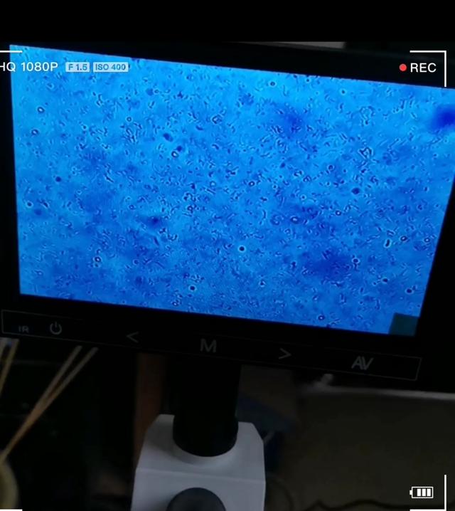 池塘高温最容易起蓝藻怎么预防,高温天气虾塘如何处理青苔