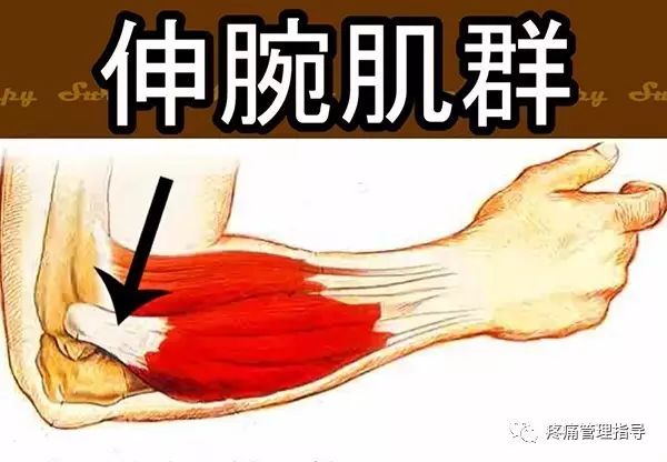 网球肘能自我恢复吗,网球肘病因的解剖学研究