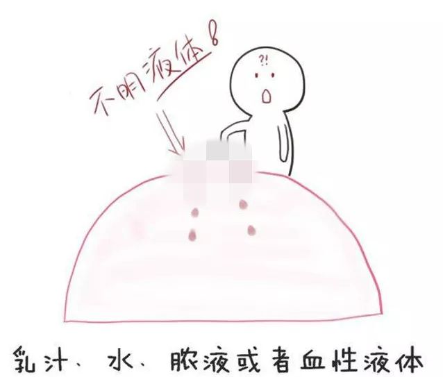 乳头出水？有分泌物？快看看究竟是怎么回事