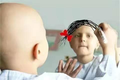 三岁小孩身上有淤青是怎么回事,女童身上出现两三个淤青要紧吗