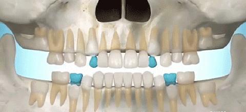 缺失牙公益广告韩国,缺失牙修复的视频
