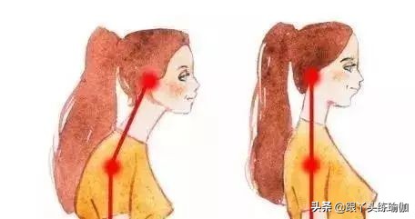 乌龟缩脖法治疗颈椎,乌龟脖颈椎前倾