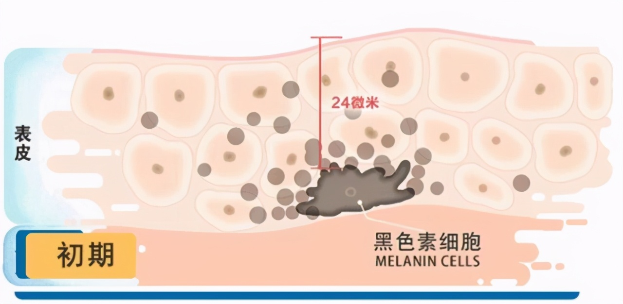 面膜多久敷一次效果才会比较好,面膜敷多长时间用完要不要洗脸了