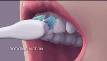 牙齿矫正好以后又长智齿,儿童牙齿矫正佩戴钢丝会更蛀牙吗