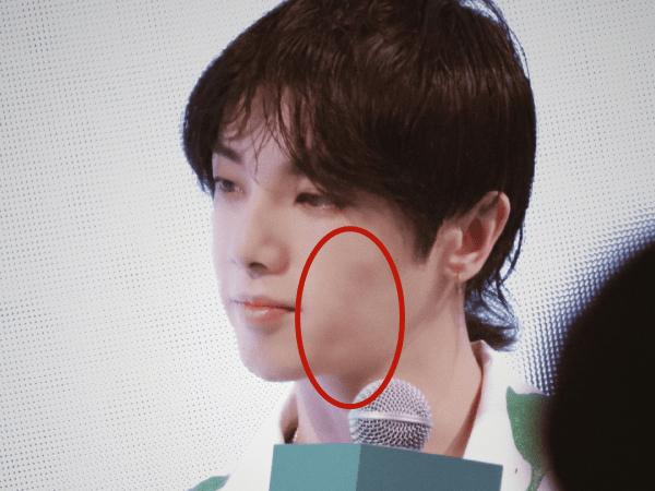 为什么华晨宇植发效果好,华晨宇植发图片是真的吗