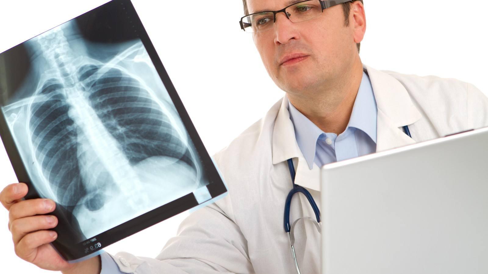 软骨黏液样纤维瘤的形成,软骨粘液样纤维瘤