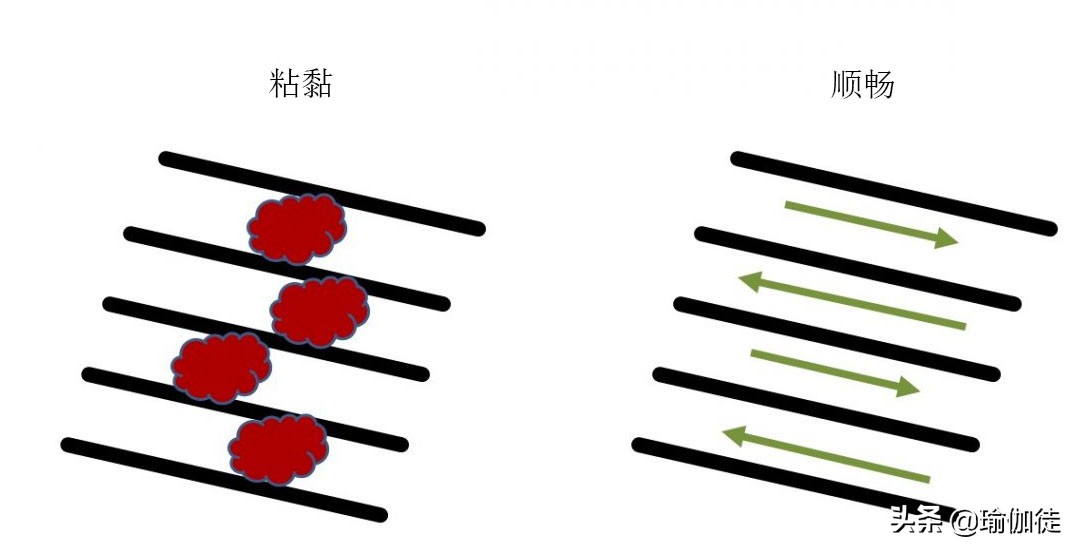 腕隧道征,腕道症候群怎么治疗