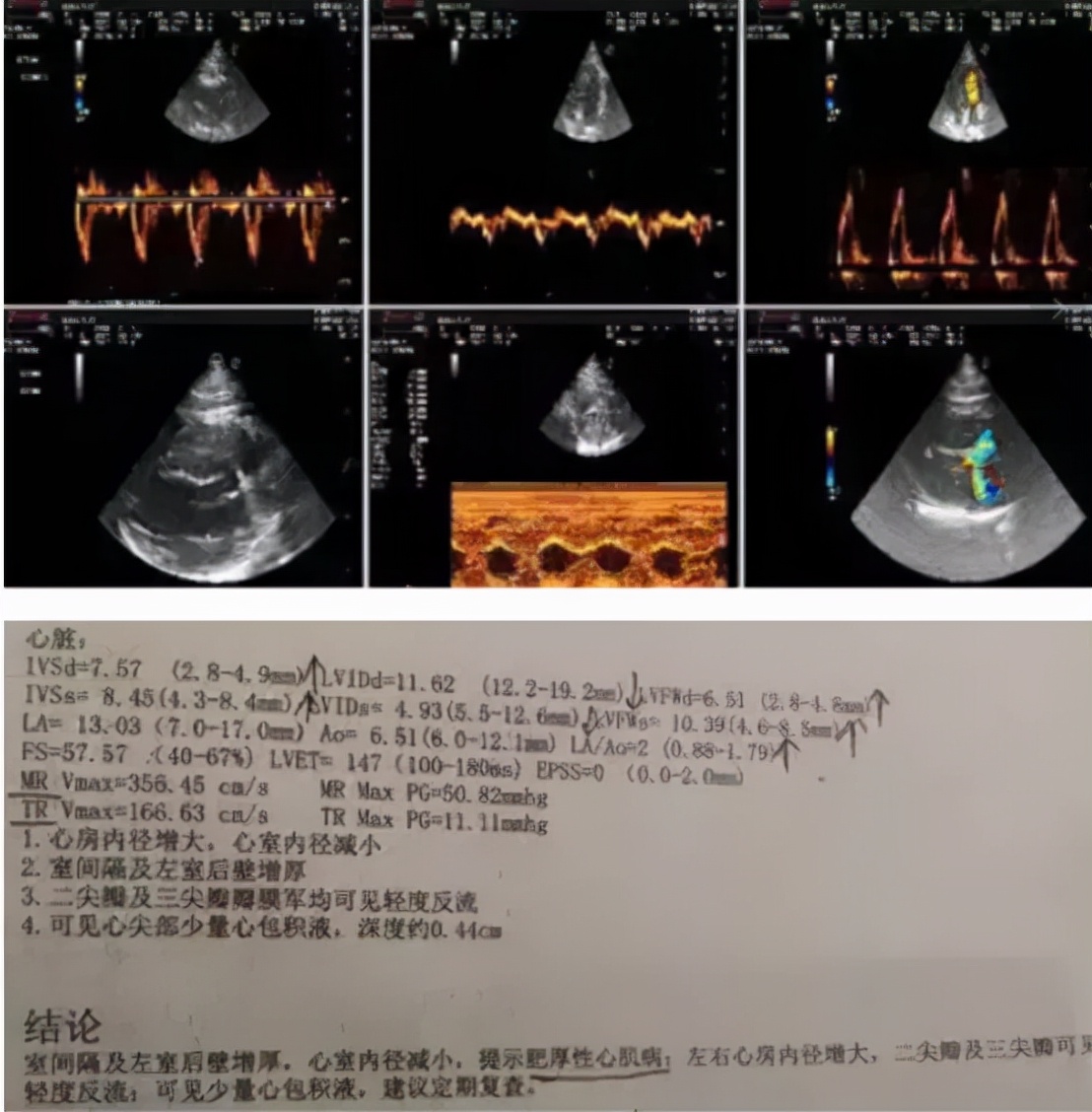 2分钟,夺走小猫咪的命