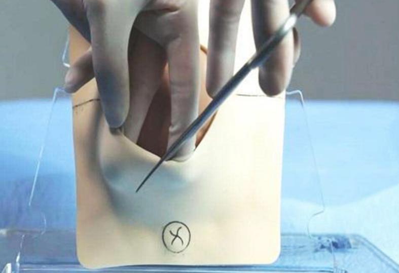 每个孕妇顺产大部分都是侧切吗,为什么孕妇都选择顺产