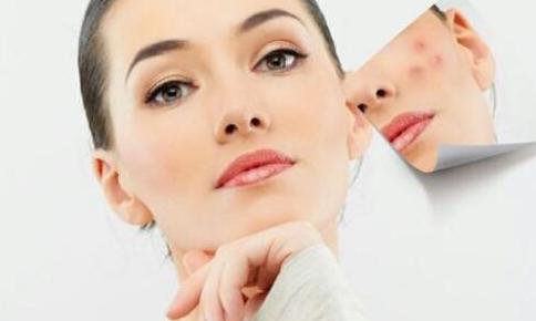 教你几招祛痘印的最快方法,怎么祛痘印最简单实用的方法