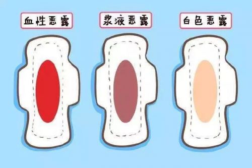 产后怎么知道恶露有没有排尽,产后怎么知道恶露是否排干净了